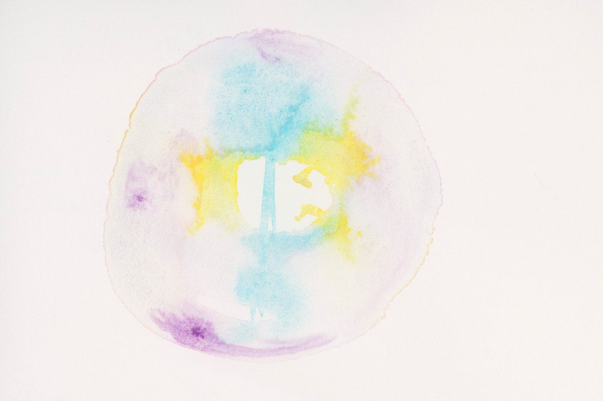 Chromosom 2-04