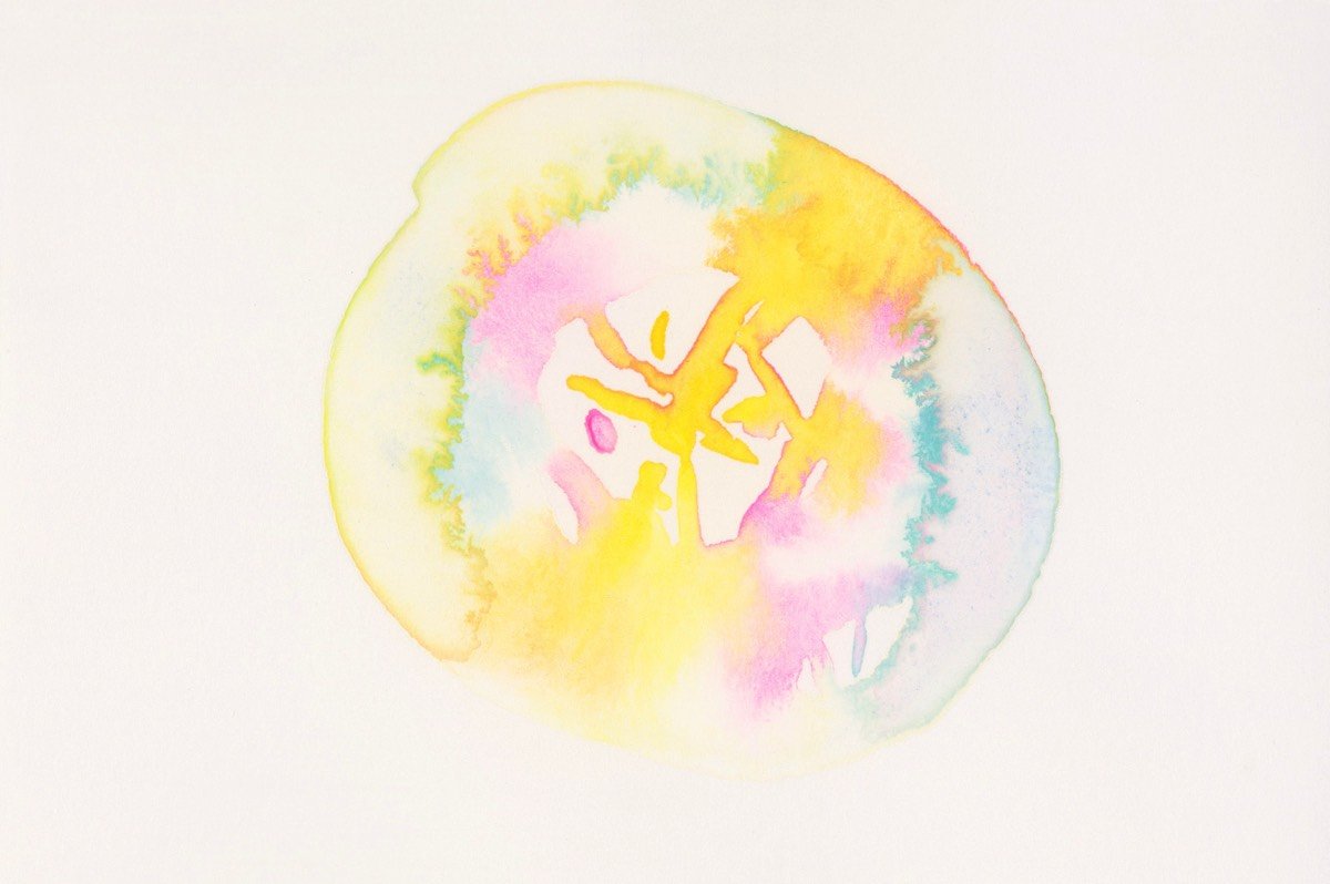 Chromosom 2-05