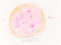 Chromosom 5 – Am Anfang (Aquarell Nr. 418)
